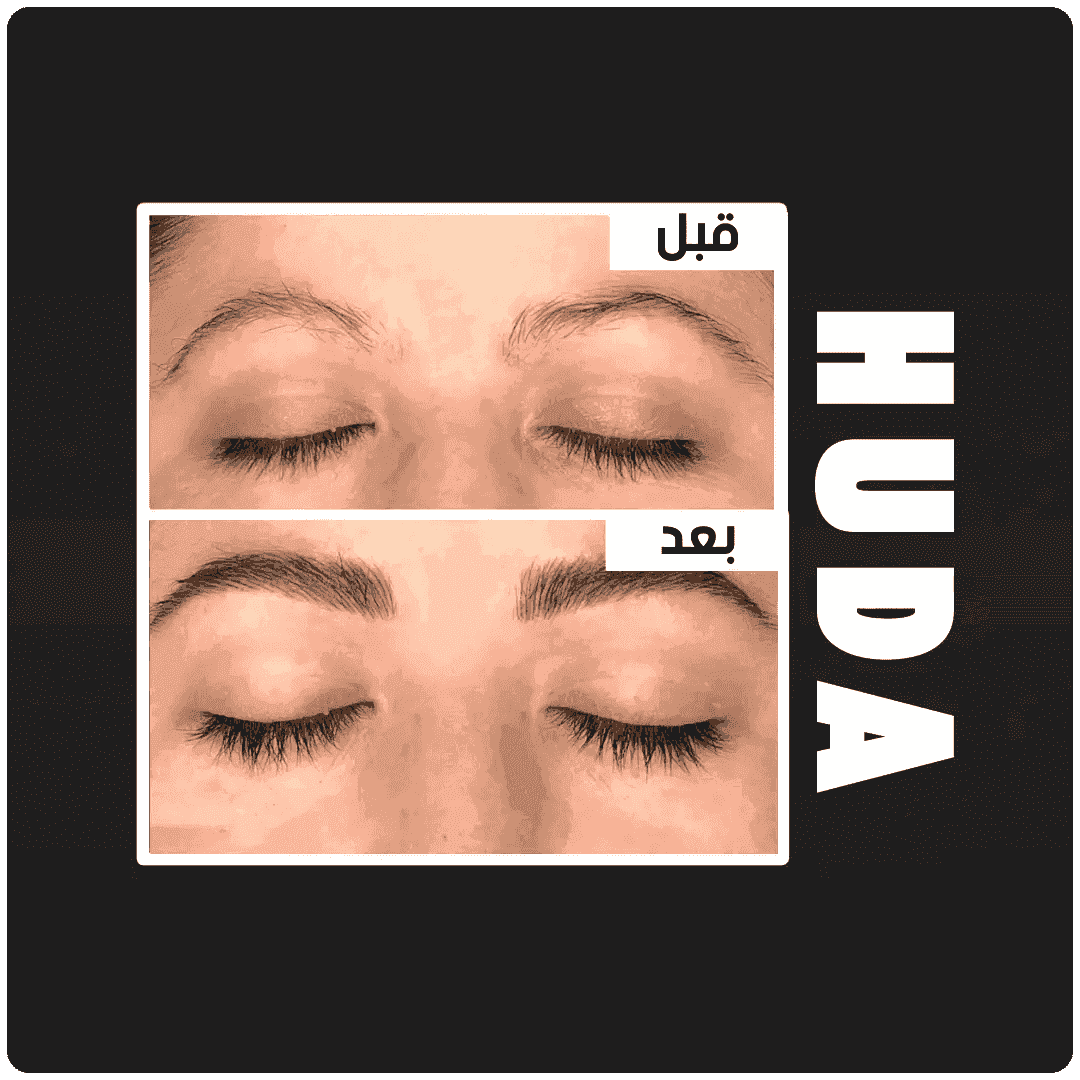 مصل نمو الرموش والحواجب - HUDA