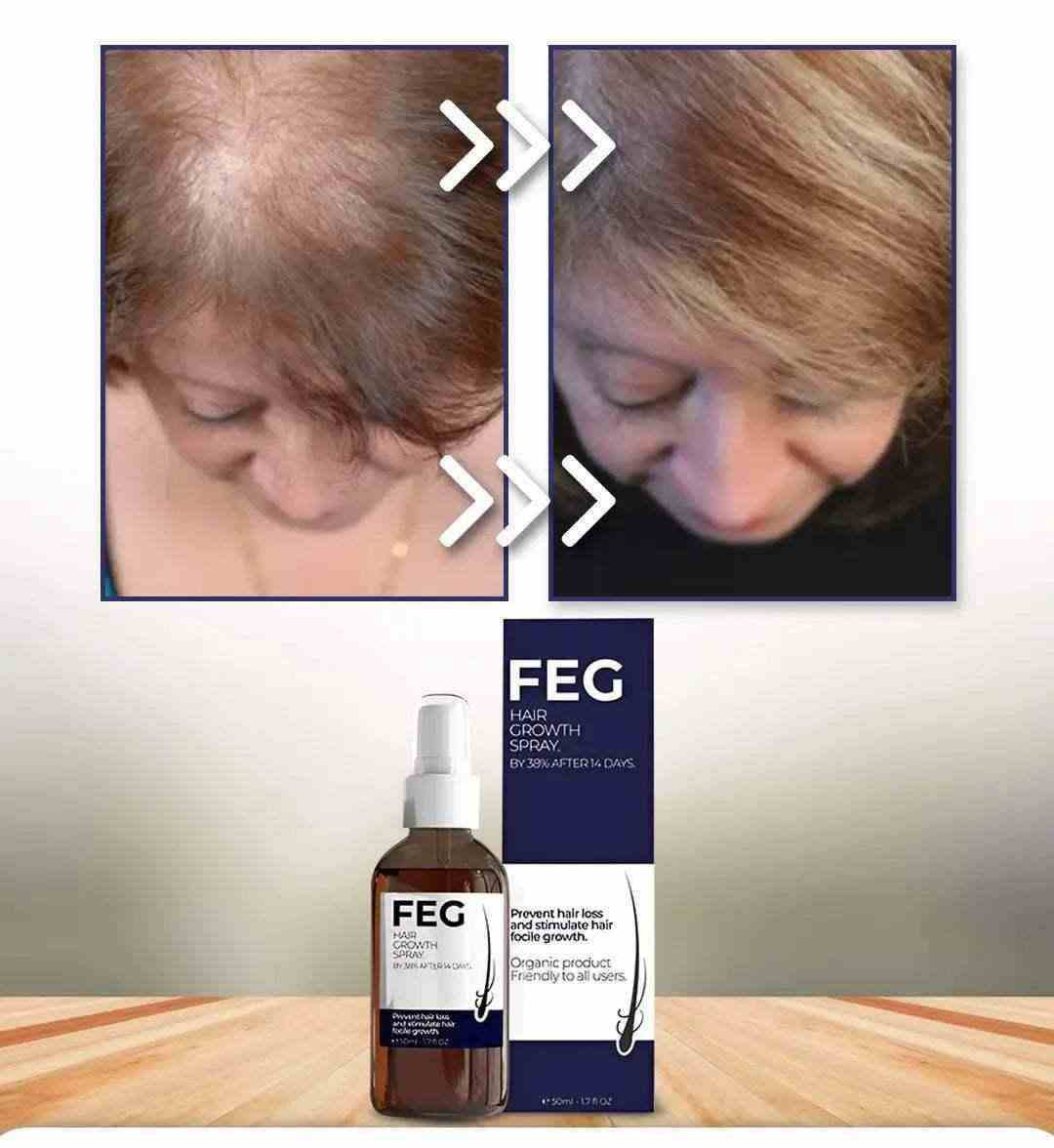 FEG Hair Growth Spray - بخاخ نمو الشعر